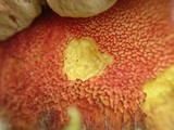 Boletus rhodoxanthus image