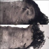 Pertusaria hymenea image