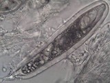 Pertusaria hymenea image