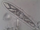 Pertusaria hymenea image