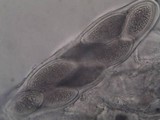 Pertusaria hymenea image