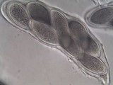 Pertusaria hymenea image