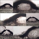 Arthopyrenia analepta image
