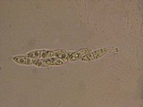Lophiotrema rubi image