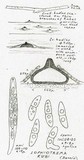 Lophiotrema rubi image