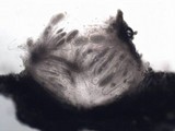 Pertusaria heterochroa image