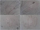 Pertusaria heterochroa image