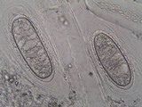 Pertusaria heterochroa image