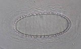 Pertusaria heterochroa image