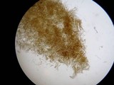 Dacryopinax elegans image