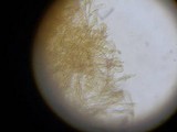 Dacryopinax elegans image