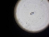 Dacryopinax elegans image