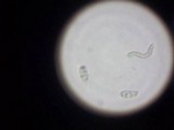 Dacryopinax elegans image