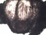 Pertusaria leioplaca image
