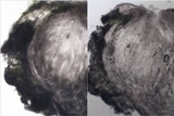 Pertusaria leioplaca image