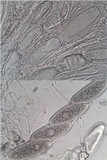 Pertusaria leioplaca image