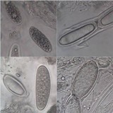 Pertusaria leioplaca image