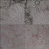Lecanora rubicunda image