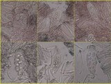 Lecidella elaeochroma f. elaeochroma image