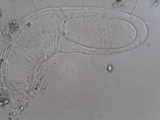Pertusaria pustulata image