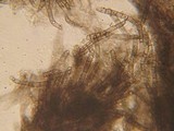 Lasiosphaeria hirsuta image