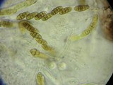 Cucurbitaria elongata image