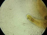 Pleospora herbarum image