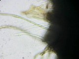 Ophiobolus acuminatus image