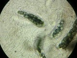 Kirschsteiniothelia aethiops image