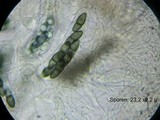 Kirschsteiniothelia aethiops image