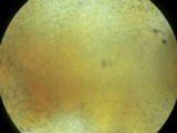 Leptosphaeria fuscella image