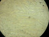 Leptosphaeria fuscella image
