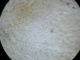 Leptosphaeria fuscella image