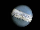 Leptosphaeria haematites image