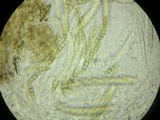 Leptosphaeria haematites image