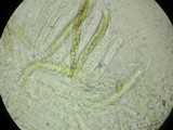 Leptosphaeria haematites image