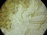 Leptosphaeria haematites image