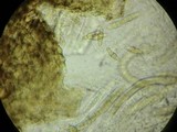 Leptosphaeria haematites image