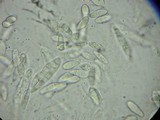 Gibberella pulicaris image