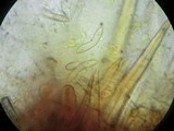 Lasiosphaeria strigosa image