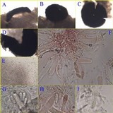 Collemopsidium foveolatum image