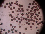Scleroderma areolatum image