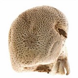Scleroderma areolatum image