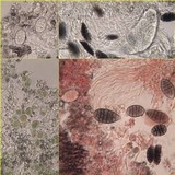 Diploschistes actinostomus image