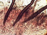 Scutellinia legaliae image