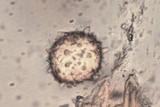 Scutellinia legaliae image