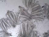 Pertusaria multipuncta image