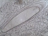 Pertusaria multipuncta image