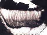 Pertusaria multipuncta image