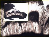 Pertusaria multipuncta image